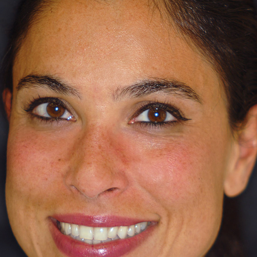 Dott. ssa Sonmez dentista pediatrica a Roma Infernetto