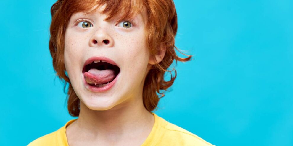 patina bianca sulla lingua dei bambini a roma